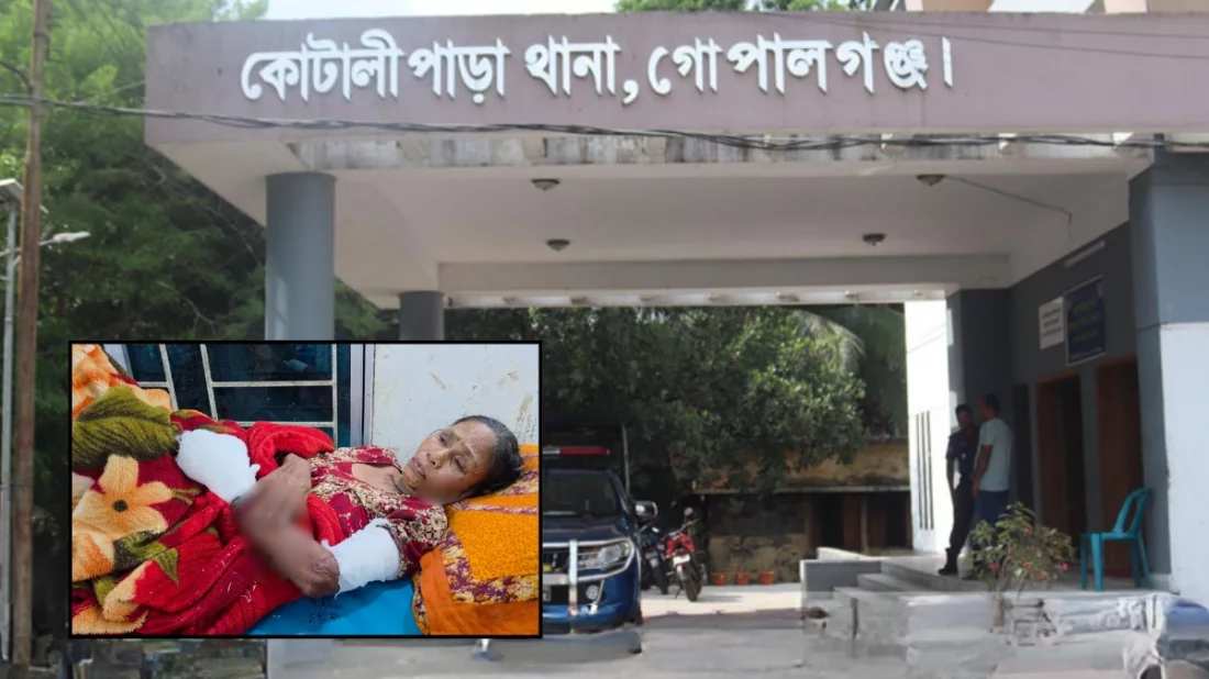 SajibKH/গোপালগঞ্জে ভাঙারি মালামাল কুড়াতে গিয়ে ককটেল বিস্ফোরণ, নারী আহত.webp
